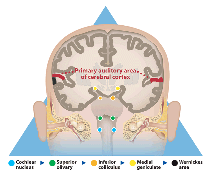 Diagram of the brain and auditory system showing the pathway from the cochlear nucleus through several areas to the primary auditory area of the cerebral cortex, with labels and color-coded dots for each region.